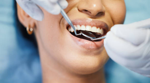 Best Emergency Broken Tooth Repair in Edwards Af, CA