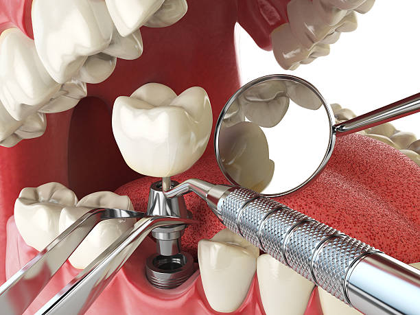 Best Weekend Emergency Dentist in Edwards Af, CA