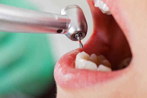 Best Walk-In Emergency Dentist in Edwards Af, CA